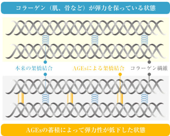 AGEsと骨